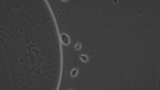 ZEISS Axio LabA1 Phase contrast live microscopy of trichomonads [upl. by Eelrebmik755]