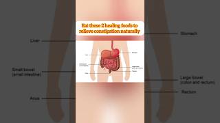 Relieve Constipation Naturally I DrAshishSachan [upl. by Haldan]