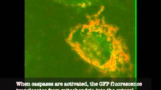 Cells undergoing cell death by apoptosis [upl. by Akemaj]