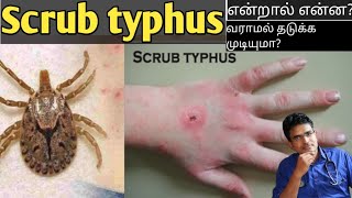 Scrub typhus in tamilmedical awareness in tamil [upl. by Aileek]