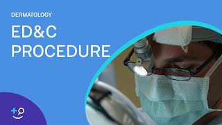 EDampC Procedure Overview Dermatology [upl. by Clio]