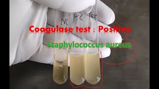 Coagulase test tube method observation [upl. by Kial687]