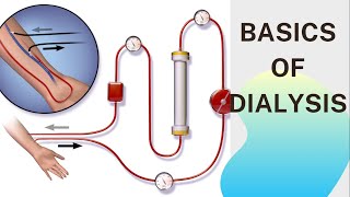 Basic concept of Dialysis Machine  Fresenius 4008S  Dialyzer amp Dialysate Function [upl. by Aicenet667]