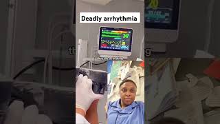 Deadly arrhythmia highlights [upl. by Mun]