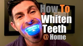 How To Whiten Teeth At Home  Teeth Whitening Options [upl. by Nylirej]