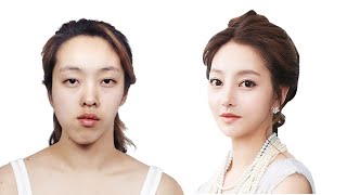 Top 5 Drastic Korean Plastic Surgery TV Show Transformations  Seoul Guide Medical [upl. by Fisuoy]