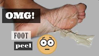 First Time Trying A Natural Foot Peel  Earth Therapeutics Foot Peel Review [upl. by Butta]