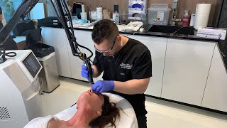 Ablative Erbium Laser for Skin Resurfacing  West Hollywood CA  Dr Jason Emer [upl. by Sezen]