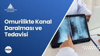 Omurilikte Kanal Daralması ve Tedavisi  Prof Dr Ahmet Hilmi Kaya [upl. by Asssilem638]