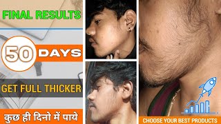 BEARD GROWTH  कुछ ही दिनो में पायें Get full thicker beard  Final results 50 days □ Mars by ghc [upl. by Raddie]