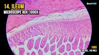 14 Ileum Microscope 40x1000x [upl. by Eastman]