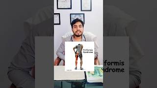 Piriformis Syndrome pain  Dr Akram  thai ka dardpiriformissyndromepiriformis painphysiotherapy [upl. by Eilama]