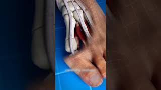 Bunion Correction explained 3danimation shorts [upl. by Banebrudge509]