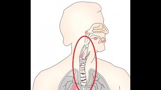 وصفة ممتازه ومجربة لعلاج الكحة والتهاب الحلق لا تفوتك [upl. by Christine]