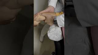 FRACTURA LUXACION DE CODO ELBOW FRACTURE DISLOCATION [upl. by Mal267]