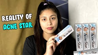 Acnestar Gel review  How to Get rid of Acne  Noni Roga [upl. by Llaccm]