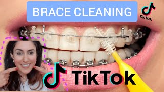 Orthodontist Reacts To Braces Cleaning Tik Toks [upl. by Sehcaep336]