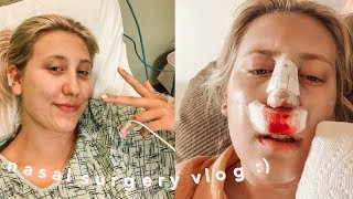 I GOT A SEPTOPLASTY RHINOPLASTY  TURBINATE REDUCTION [upl. by Mcdermott218]