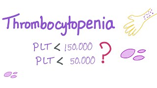 Thrombocytopenia  Why Is My Platelet Count Low [upl. by Nicram]