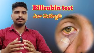 How to Bilirubin test in TeluguBilirubin test in Telugu bloodpressure bilirubin [upl. by Nahshu719]