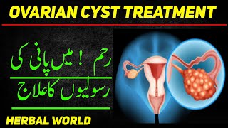 Ovarian cyst Treatment  Cyst symptoms  pani ki rasoli Ka Ilaj  Herbal world [upl. by Nnylg49]