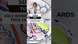 Comprendre et Prévenir le SDRA  Guide pour les Infirmiers ide tutorial nurse ards covid19 [upl. by Anigger]