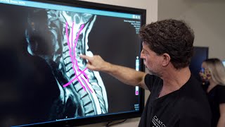 Symptoms of Cervical Stenosis  Jeffrey Cantor MD [upl. by Yehudi175]