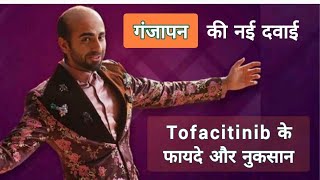 गंजापन की नई दवाई Tofacitinib के फायदे और नुकसान  Alopecia Areata का इलाज alopecia hairfall [upl. by Mercie]