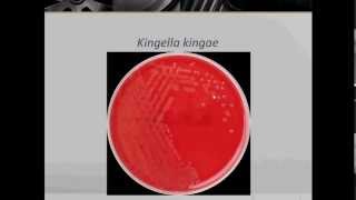 Bacteriology Gram Negative Coccobacilli Part 1 [upl. by Sirroned682]