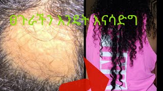 My Alopecia Story treatmentHome remedyላሽት እንዴት በቤታችን እናሳድጋለን [upl. by Ardy722]