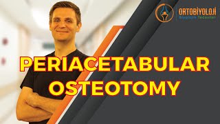 PERIACETABULAR OSTEOTOMY  GANZ OSTEOTOMY [upl. by Iat409]