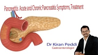 Pancreatitis  Acute and Chronic Pancreatitis Nursing Lecture Symptoms Treatment Dr Kiran Peddi [upl. by Dnaltroc376]