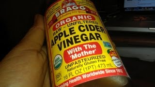 How To Pass a Kidney Stones Free and Naturally Treat Dissolve ACV health [upl. by Hakeber]