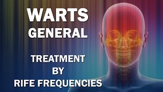 Warts General  RIFE Frequencies Treatment  Energy amp Quantum Medicine with Bioresonance [upl. by Hammond]