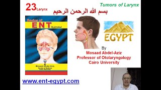 Larynx 3 Mosaad AbdelAziz Tumors of Larynx [upl. by Lurette704]