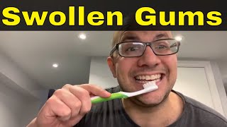 How To Reduce Swollen Gums At Home6 Easy Ways [upl. by Keslie]