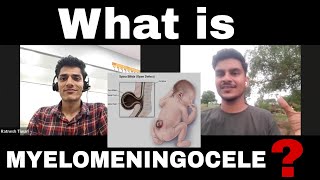 What is Myelomeningocele Watch Full Story of Patient  Ashishsharmavlogsofficial spinalcord [upl. by Enitsuj]