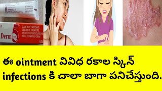 Dermi 5 ointment uses and side effects in teluguBest skin infection ointment [upl. by Inan]