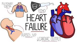 Heart Failure Explained  HFrEF vs HFpEF Systolic vs Diastolic Heart Failure [upl. by Ennovyhc238]