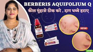 Berberis Aquifolium Q for Acne amp Pigmentation Best Homeopathic Medicine  Dr Arwa Bohra [upl. by Adelind]