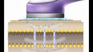 UltraschallVitalwellentherapie mit Vsonic [upl. by Basilius]