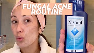 Treat Fungal Acne With This Skincare Routine  SKINCARE [upl. by Aicilram]