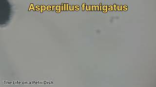 Aspergillus niger fumigatus and flavus [upl. by Joannes]