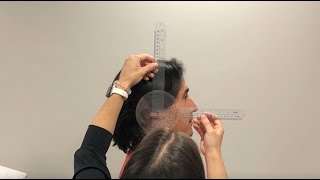 Range of Motion Measurement Cervical Extension [upl. by Hirsch]