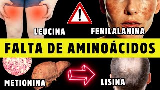 SINAIS DE ALERTA de DEFICIÃŠNCIA dos 9 AMINOÃCIDOS ESSENCIAIS  Dr Alain Dutra [upl. by Negiam409]