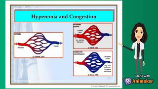 Hyperemia and Congestion  fluid and hemodynamics  pathology [upl. by Ninahs]