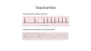 Protocolo de manejo de bradicardia y taquiarritmias AHA [upl. by Moira159]