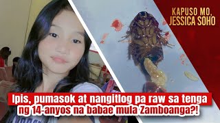 Ipis pumasok at nangitlog pa raw sa tenga ng 14anyos na babae  Kapuso Mo Jessica Soho [upl. by Lowenstern]