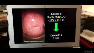 Papilloma Virus Video Liverani VP8 [upl. by Ahseiym]