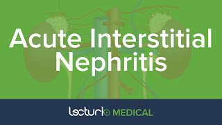 Acute Interstitial Nephritis  AKI  Nephrology [upl. by Eidda]